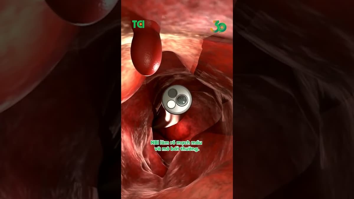 Nội soi tiêu hóa Endocyto 520x - Soi rõ tận cấu trúc tế bào