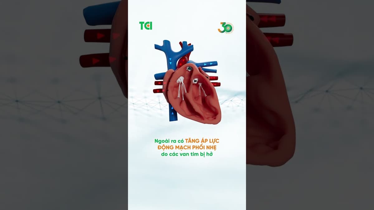 Đau thắt ngực không chỉ do tim, nhiều nguyên nhân tiềm ẩn có thể bạn chưa biết.