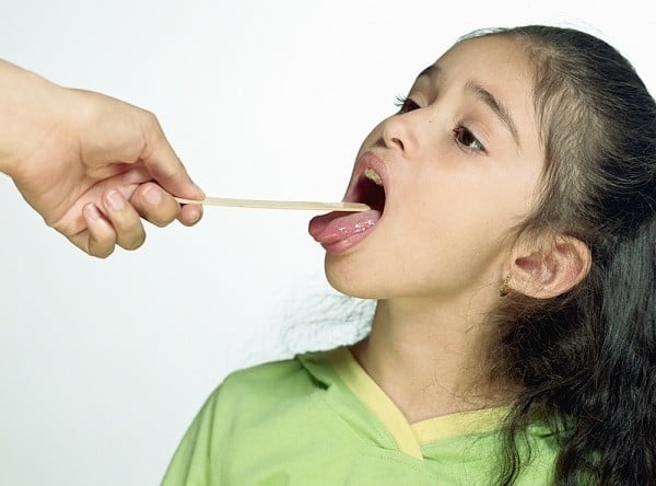 Chữa viêm họng đau rát nuốt thấy khó khăn và rất khó chịu