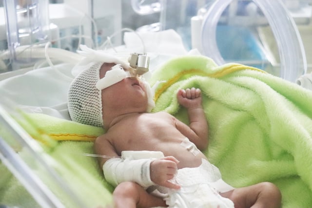 Khám mắt cho trẻ sinh non tại Thu Cúc TCI