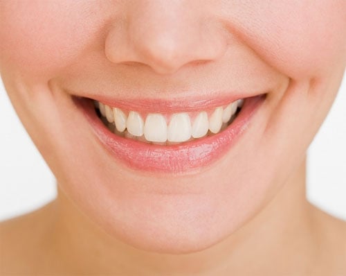 Niềng răng một hàm giá bao nhiêu? chi phí khám hợp lý