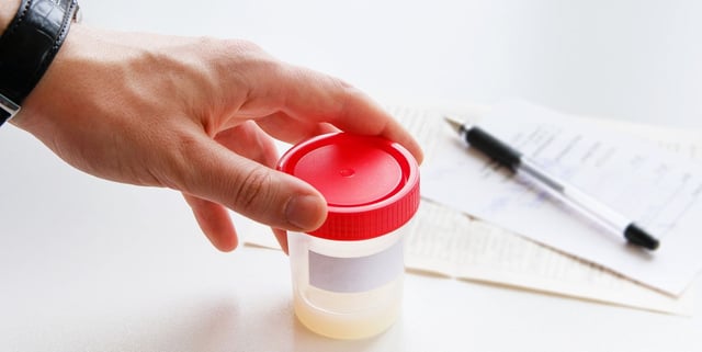 Xét nghiệm tinh dịch đồ vô sinh, hiếm muộn