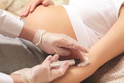 Xét nghiệm trước khi sinh con khám thai định kì