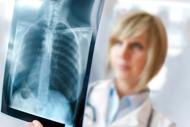 Viêm phổi ở trẻ em: Biến chứng nguy hiểm và cách điều trị