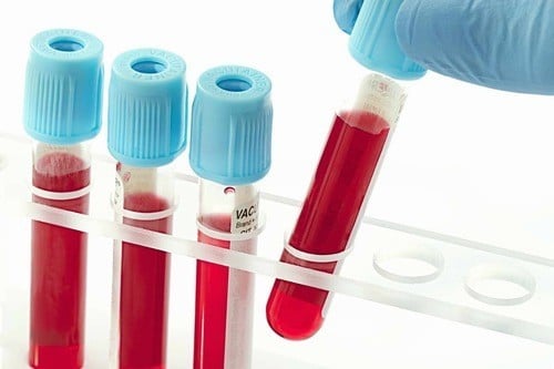 4 xét nghiệm cần làm ở tuổi 30