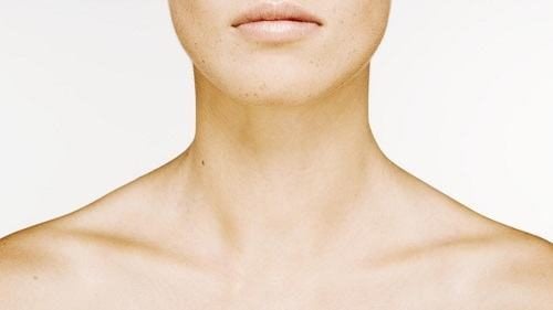 Chi phí mổ gãy xương đòn bao nhiêu tiền &amp; khi nào phải mổ?