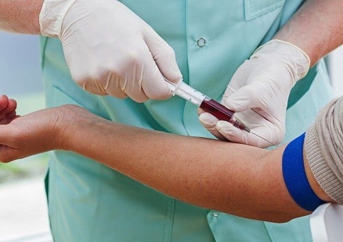 Xét nghiệm ung thư tuyến tiền liệt