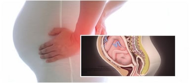 Đau xương mu ở bà bầu có sao không? điều cần quan tâm