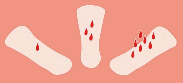 Ra máu trước kỳ kinh nguyệt: Nguyên nhân và cách xử trí