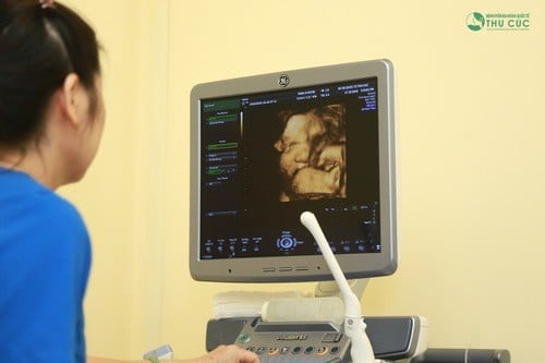 Siêu âm 2 tuần 1 lần có sao không?