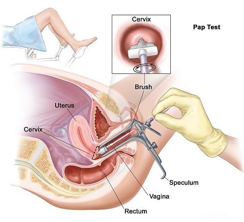 Xét nghiệm tế bào cổ tử cung có đau không?