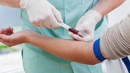 Các chỉ số xét nghiệm sinh hóa máu