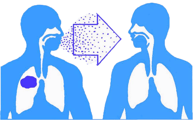 Bệnh lao phổi có lây không? nguyên nhân nào gây nên