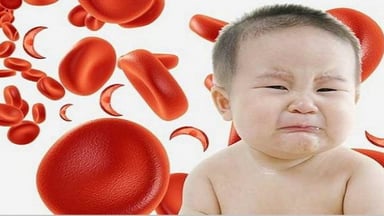 Thiếu máu ở trẻ em nguyên nhân và cách điều trị