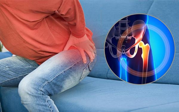 Trật khớp háng &#8211; nguyên nhân và cách xử lý