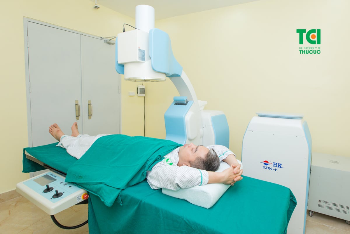 Sỏi thận canxi – loại sỏi chiếm hơn 80%  mắc sỏi thận