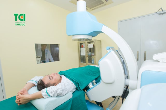 Tán sỏi ngoài cơ thể ESWL &#8211; điều trị sỏi tiết niệu không cần mổ