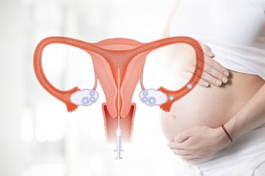 Những điều nên biết về phương pháp bơm tinh trùng vào tử cung