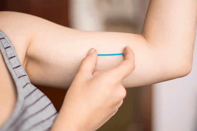 Giải đáp thắc mắc: Cấy que tránh thai có tác dụng phụ gì?