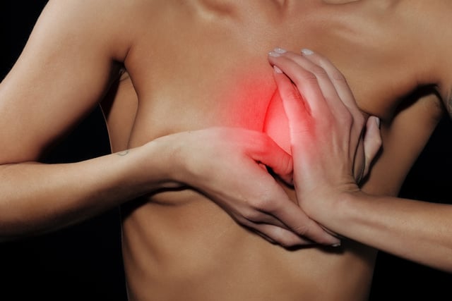 Áp xe vú là gì, nguyên nhân và cách điều trị như thế nào?