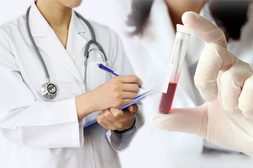 Những gì cần biết về xét nghiệm rối loạn phóng noãn