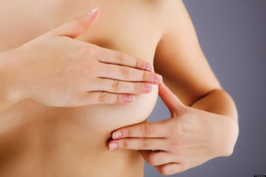 U nang tuyến vú là gì? Dấu hiệu nhận biết và cách điều trị