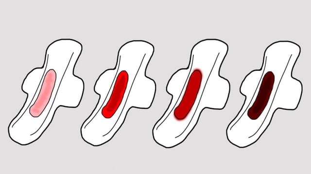 Chảy máu âm đạo bất thường &#8211; dấu hiệu nguy hiểm chớ coi thường!