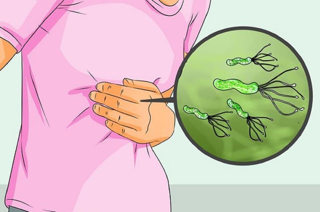 Vi khuẩn H pylori là gì: con đường lây nhiễm và phòng bệnh