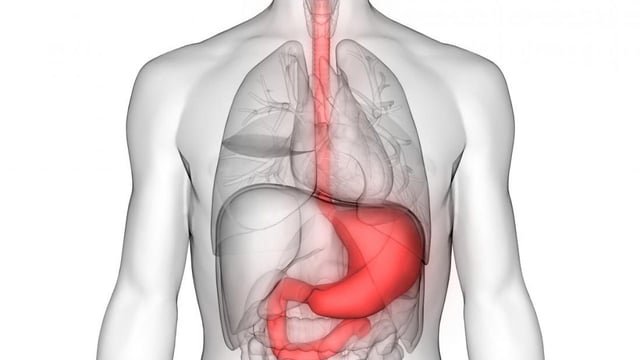 Bệnh xuất huyết tiêu hóa trên: Nguyên nhân và cách điều trị