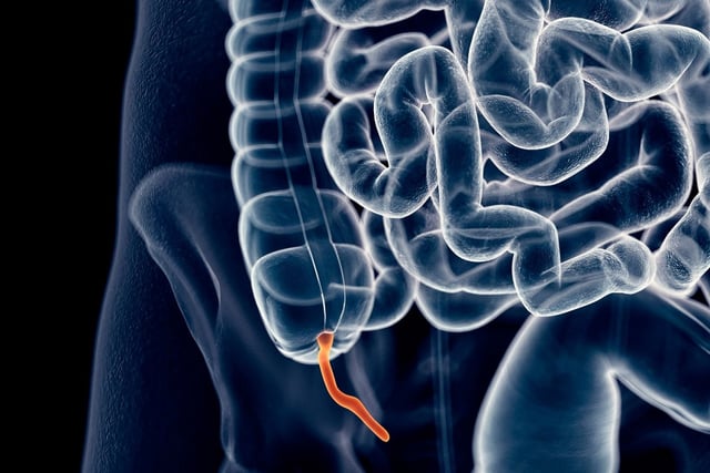 Viêm ruột thừa cấp được điều trị như thế nào?