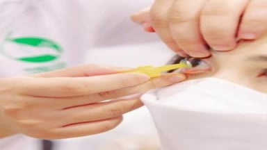 Các tật khúc xạ về mắt điều trị bằng cách nào an toàn nhất?