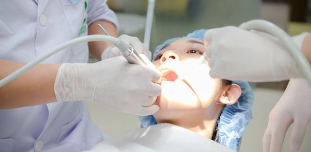 Tìm hiểu về kỹ thuật chụp tủy răng bằng MTA