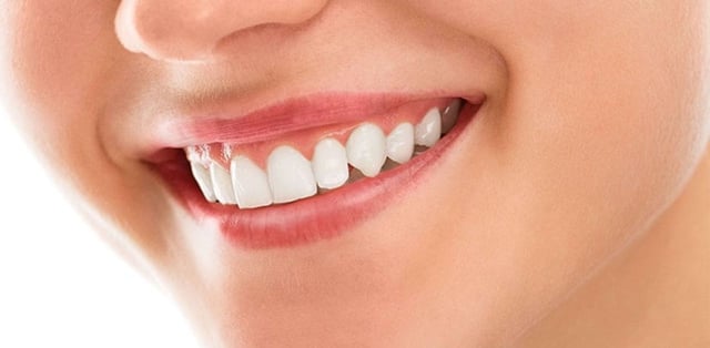 Tìm hiểu về phương pháp phẫu thuật đường cười hở lợi