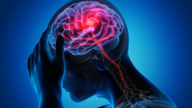 Bệnh động kinh: Nguyên nhân và phương pháp điều trị