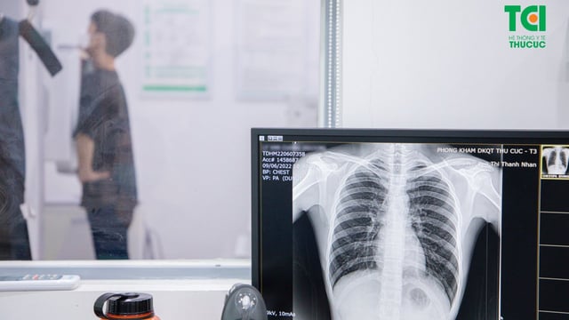 Tầm soát phổi có phát hiện ung thư không?