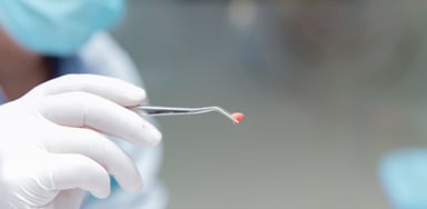 “Cấp cứu” kịp thời một trường hợp nhổ răng số 8 còn sót chân răng