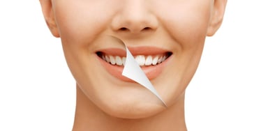 Tìm hiểu về các dịch vụ nha khoa thẩm mỹ hiện nay