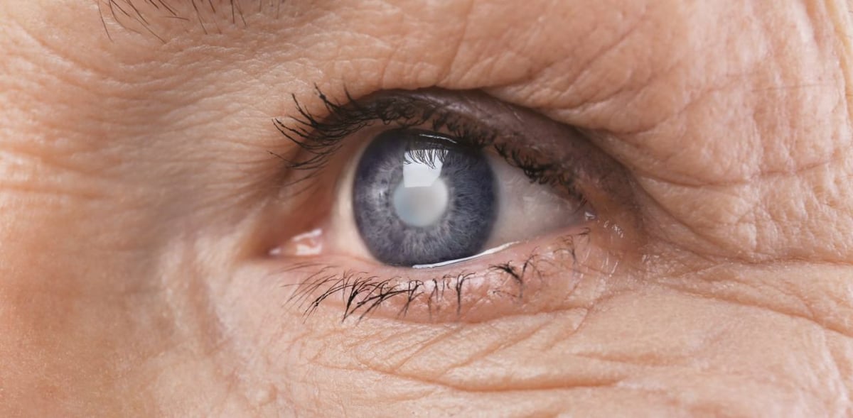 Thiên đầu thống là bệnh gì, có nguy hiểm không?