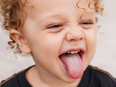 Chuyên gia giải đáp: Nấm miệng có tự khỏi được không?