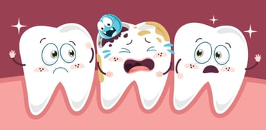 Răng hàm sâu nặng &#8211; Biến chứng nguy hiểm, cần điều trị kịp thời