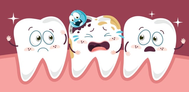 Răng hàm sâu nặng &#8211; Biến chứng nguy hiểm, cần điều trị kịp thời