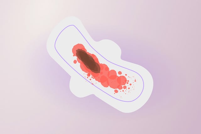 Do đâu mà sản phụ gặp tình trạng rong kinh sau sinh thường 