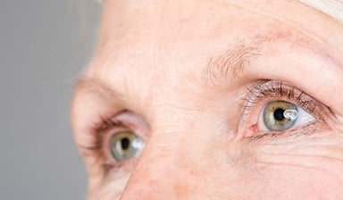 Những điều cần biết về thoái hóa hoàng điểm ở mắt