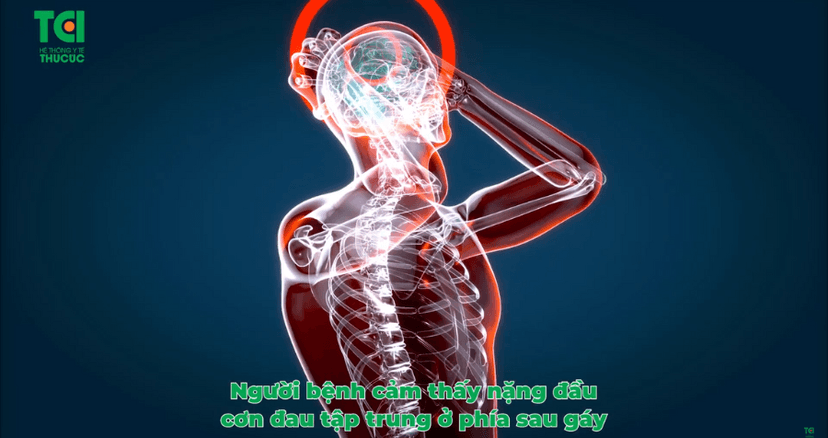Thiếu máu não: Dấu hiệu nhận biết và biến chứng nguy hiểm