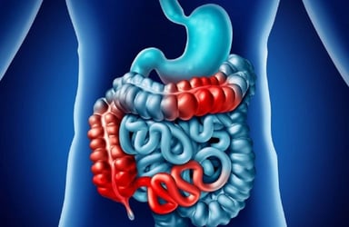 10+ Mẹo chữa đại tràng co thắt bạn cần biết