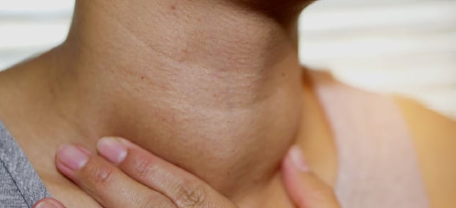 Giải đáp ung thư tuyến giáp có nguy hiểm không?