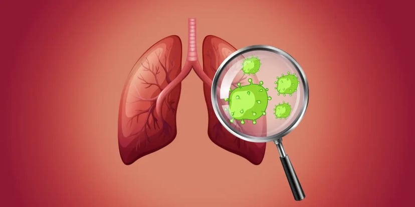 Tìm hiểu những dấu hiệu ung thư phổi giai đoạn đầu
