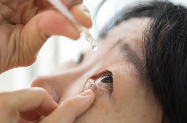 Những điều cần biết về tăng nhãn áp góc mở