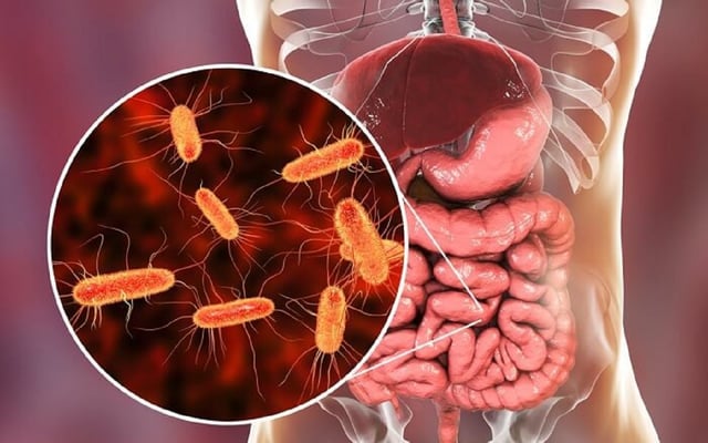 &#8220;Giải mã&#8221; viêm ruột dạ dày và cách điều trị