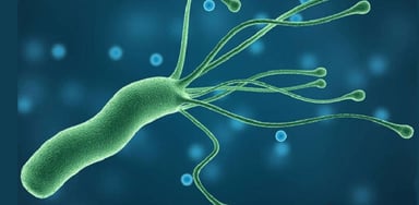Vi khuẩn HP có chữa khỏi không?